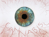 Image of an eyeball showing the effects of cannabis.